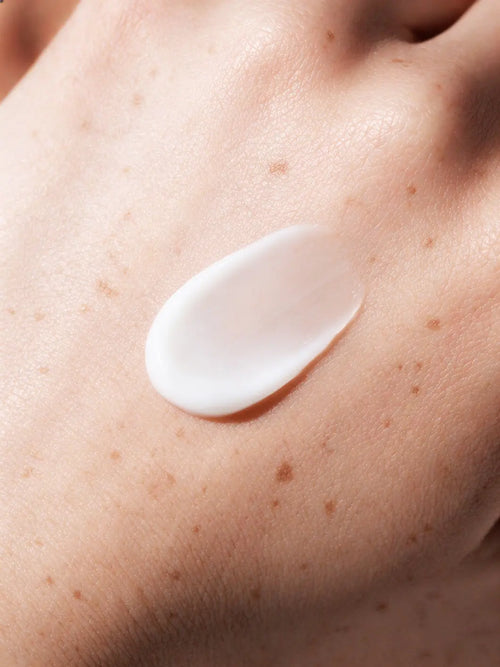 Snow-white lightweight eye cream in a soft rounded shape on very fair skin with visible freckles and natural texture